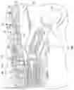 Fig. 07 - Devices, systems and methods for minimally invasive glaucoma surgery