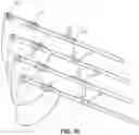 Fig. 13 - Stackable eye shields with selectively releasable snap-fit assembly