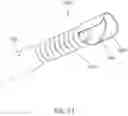 Fig. 14 - CERUMEN REMOVAL APPARATUS