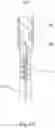 Fig. 15 - CERUMEN REMOVAL APPARATUS