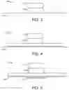 Fig. 03 - ADVANCED DIGIT DRESSING
