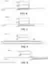 Fig. 04 - ADVANCED DIGIT DRESSING