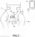 Fig. 04 - Diaper adapted to mount a wetness notifying device