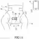 Fig. 12 - Diaper adapted to mount a wetness notifying device