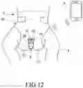 Fig. 13 - Diaper adapted to mount a wetness notifying device