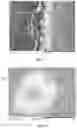Fig. 05 - ABSORBENT ARTICLE WITH HYBRID NONWOVEN WEB