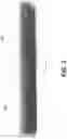 Fig. 04 - Flatulence silencer and odor eliminator