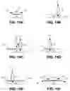 Fig. 17 - Apparatus and method for reorienting a person