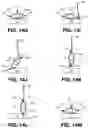 Fig. 18 - Apparatus and method for reorienting a person