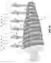 Fig. 38 - Apparatus and method for reorienting a person