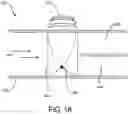 Fig. 19 - Robotic systems, operating room systems, insulated conductor including biologically active material, microplastic filter, and combinations thereof