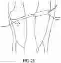 Fig. 24 - Robotic systems, operating room systems, insulated conductor including biologically active material, microplastic filter, and combinations thereof