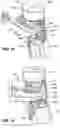 Fig. 11 - Motor and piston assembly for percussive massage device
