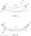 Fig. 09 - ADJUSTABLE BACK PLATE FOR MECHANICAL COMPRESSION DEVICE