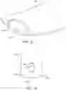 Fig. 20 - ADJUSTABLE BACK PLATE FOR MECHANICAL COMPRESSION DEVICE