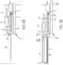 Fig. 05 - Medical fluid container preparation system and assembly