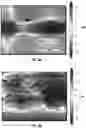 Fig. 04 - METHODS AND COMPOSITIONS FOR ALTERING TEETH