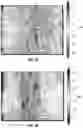 Fig. 06 - METHODS AND COMPOSITIONS FOR ALTERING TEETH