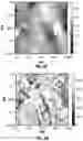 Fig. 08 - METHODS AND COMPOSITIONS FOR ALTERING TEETH