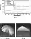 Fig. 09 - METHODS AND COMPOSITIONS FOR ALTERING TEETH