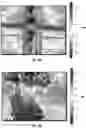 Fig. 10 - METHODS AND COMPOSITIONS FOR ALTERING TEETH