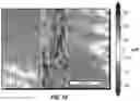 Fig. 18 - METHODS AND COMPOSITIONS FOR ALTERING TEETH
