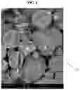 Fig. 06 - ENVIRONMENTALLY BIODEGRADABLE MICROCAPSULES