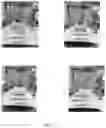 Fig. 04 - Oral Care Compositions Comprising Tin Ions