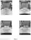 Fig. 07 - Oral Care Compositions Comprising Tin Ions