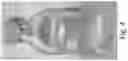 Fig. 05 - Preserved Silk Protein Fragment Compositions and Articles Manufactured Therefrom