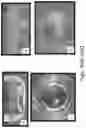 Fig. 50 - Preserved Silk Protein Fragment Compositions and Articles Manufactured Therefrom