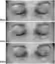 Fig. 01 - INSTANT EFFECT EYE CREAM