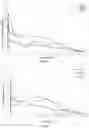 Fig. 12 - Antipsychotic injectable depot composition