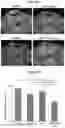 Fig. 08 - COMBINATION THERAPY FOR TREATMENT OF BRAIN DISORDERS
