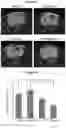Fig. 10 - COMBINATION THERAPY FOR TREATMENT OF BRAIN DISORDERS