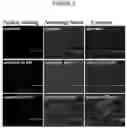 Fig. 04 - METHODS AND COMPOSITIONS FOR TREATING LYSOSOMAL STORAGE DISORDERS: AMBROXOL AS TREATMENT AGENT FOR MUCOPOLYSACCHARIDOSES III (SANFILIPPO SYNDROME)