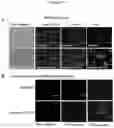 Fig. 05 - METHODS AND COMPOSITIONS FOR TREATING LYSOSOMAL STORAGE DISORDERS: AMBROXOL AS TREATMENT AGENT FOR MUCOPOLYSACCHARIDOSES III (SANFILIPPO SYNDROME)