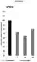 Fig. 09 - METHODS AND COMPOSITIONS FOR TREATING LYSOSOMAL STORAGE DISORDERS: AMBROXOL AS TREATMENT AGENT FOR MUCOPOLYSACCHARIDOSES III (SANFILIPPO SYNDROME)