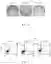 Fig. 07 - Pharmaceutical composition exhibiting anti-tumor activity, method for treating patient suffering from cancer and method for inhibiting tumor growth