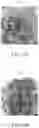 Fig. 09 - Pharmaceutical composition exhibiting anti-tumor activity, method for treating patient suffering from cancer and method for inhibiting tumor growth