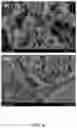 Fig. 06 - Composition for inducing pili formation in bacterium of genus 