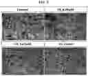 Fig. 06 - Pharmaceutical Composition for Treatment of Bone-Related Disease
