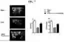Fig. 08 - Pharmaceutical Composition for Treatment of Bone-Related Disease
