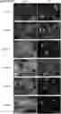 Fig. 01 - a-SYNUCLEIN AGGREGATE BINDING AGENT AND IMAGING METHOD