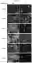 Fig. 02 - a-SYNUCLEIN AGGREGATE BINDING AGENT AND IMAGING METHOD