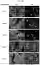 Fig. 03 - a-SYNUCLEIN AGGREGATE BINDING AGENT AND IMAGING METHOD