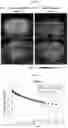 Fig. 08 - a-SYNUCLEIN AGGREGATE BINDING AGENT AND IMAGING METHOD