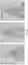 Fig. 03 - COMPOSITIONS AND METHODS FOR TREATING BASAL FOREBRAIN DISEASE