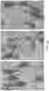 Fig. 05 - COMPOSITIONS AND METHODS FOR TREATING BASAL FOREBRAIN DISEASE