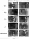 Fig. 02 - COMPOSITION OF LANOSTEROL PRODRUG COMPOUND, PREPARATION METHOD THEREFOR AND USE THEREOF